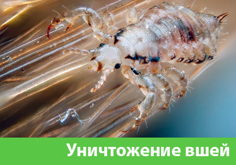 Уничтожение вшей в городе Нижний Тагил